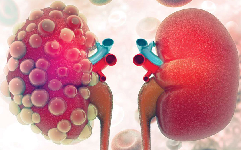 What To Eat For Healthy Kidneys - NaturalHealth - Healthy, Beauty