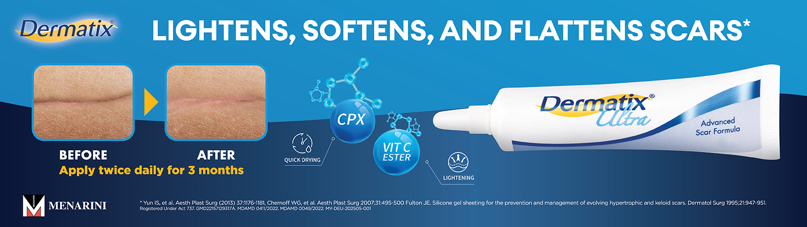 Dermatix® Ultra